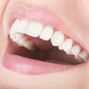 כיצד מבצעים השתלת שיניים בפה?